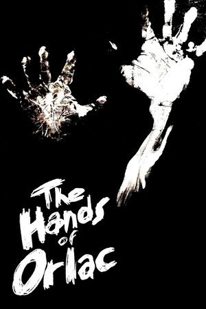The Hands of Orlac poszter